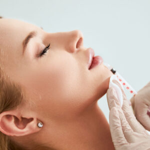Lip Filler